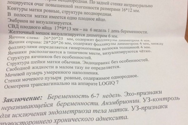 Кракен кз